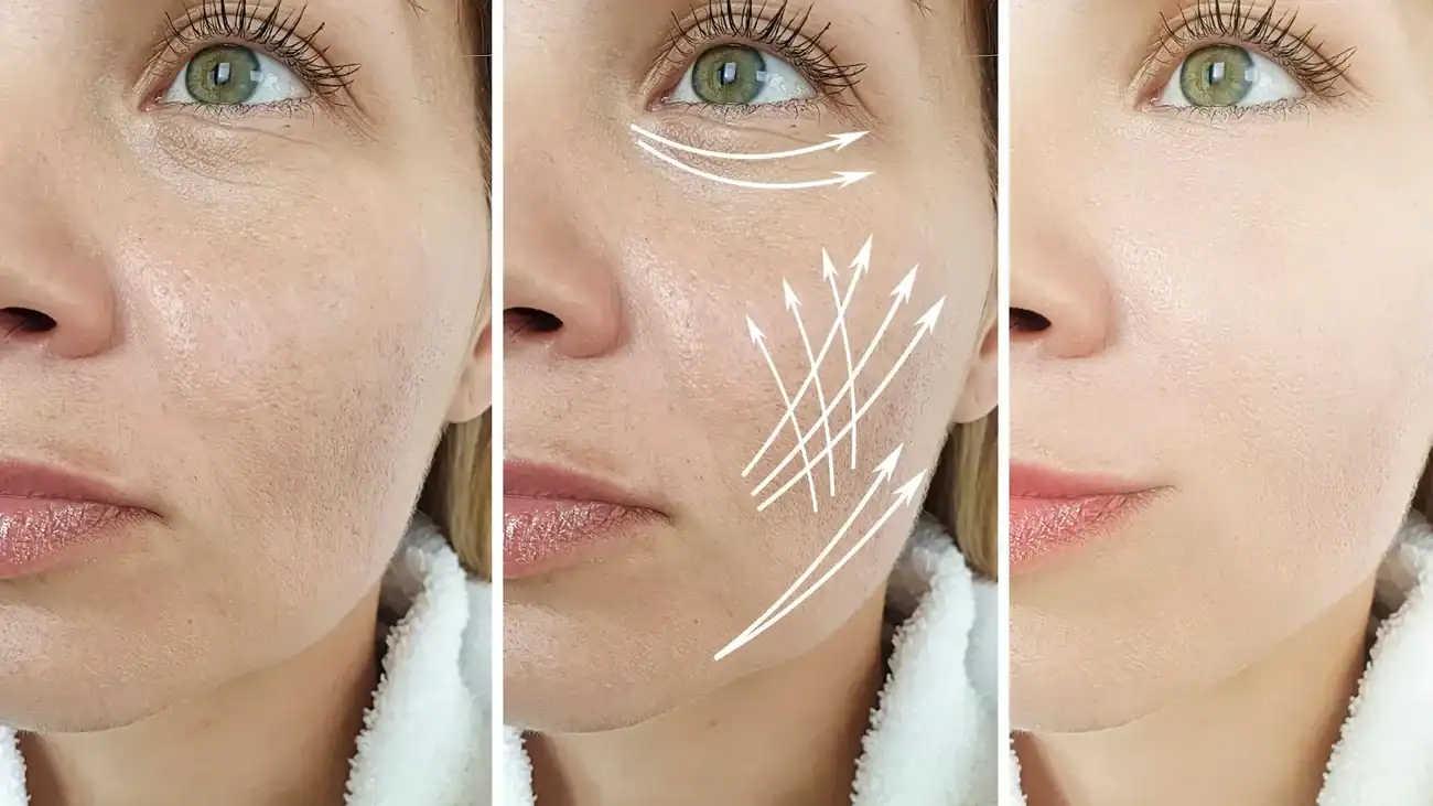 Can One Treatment Really Tackle More Than One Skin Concern Chippenham?