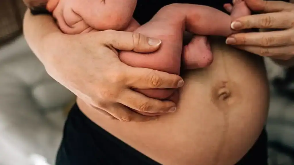 Why Is My Stomach Still Big After Pregnancy Chippenham?