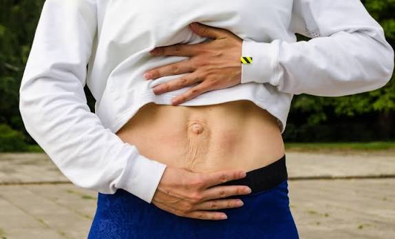 When Could Diastasis Recti Be the Missing Piece of the Puzzle Chippenham?